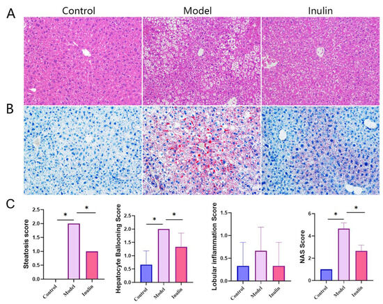 Serum Metabolomics Uncovers the Mechanisms of Inulin in Preventing Non ...