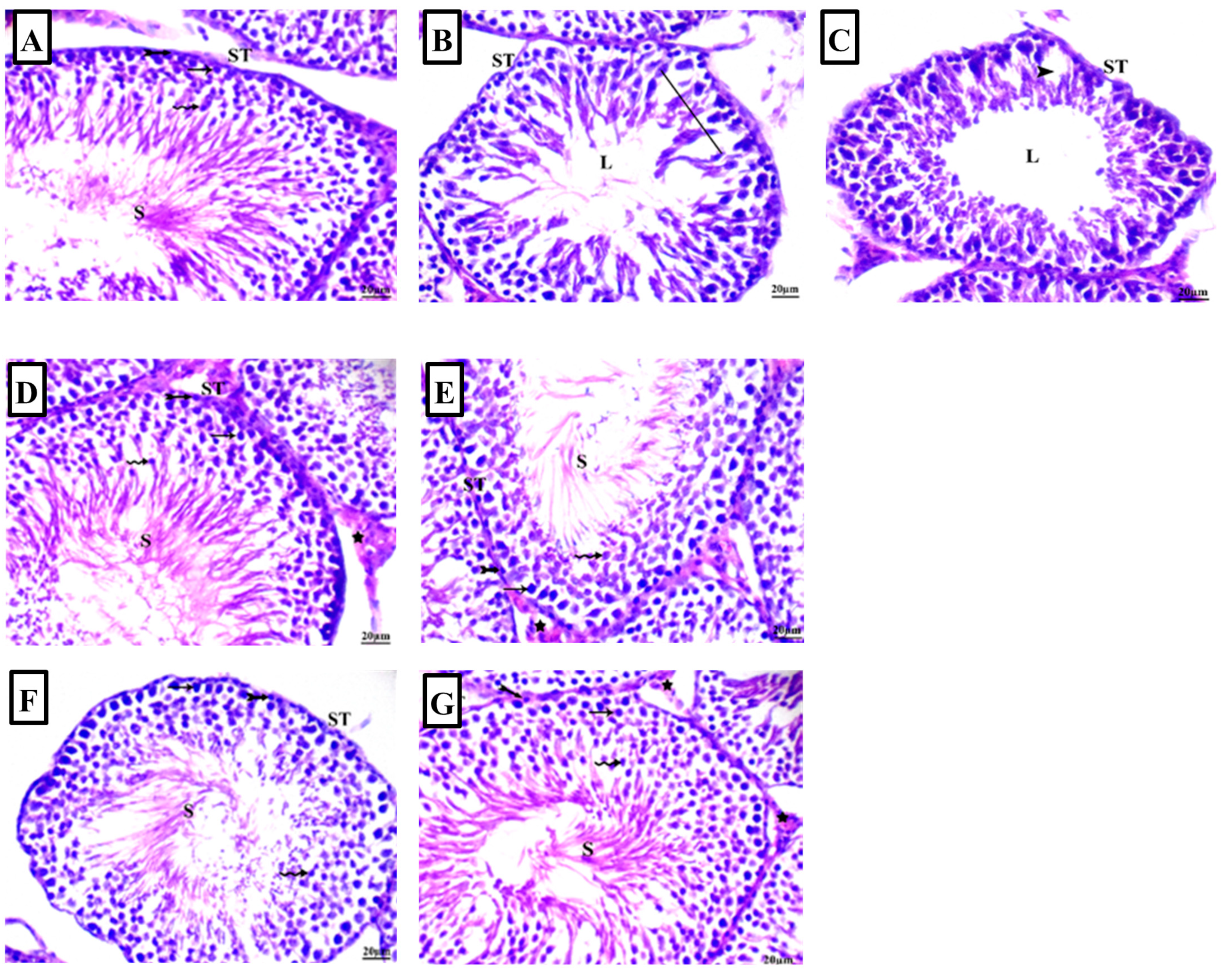 Pharmaceuticals 17 00909 g004a