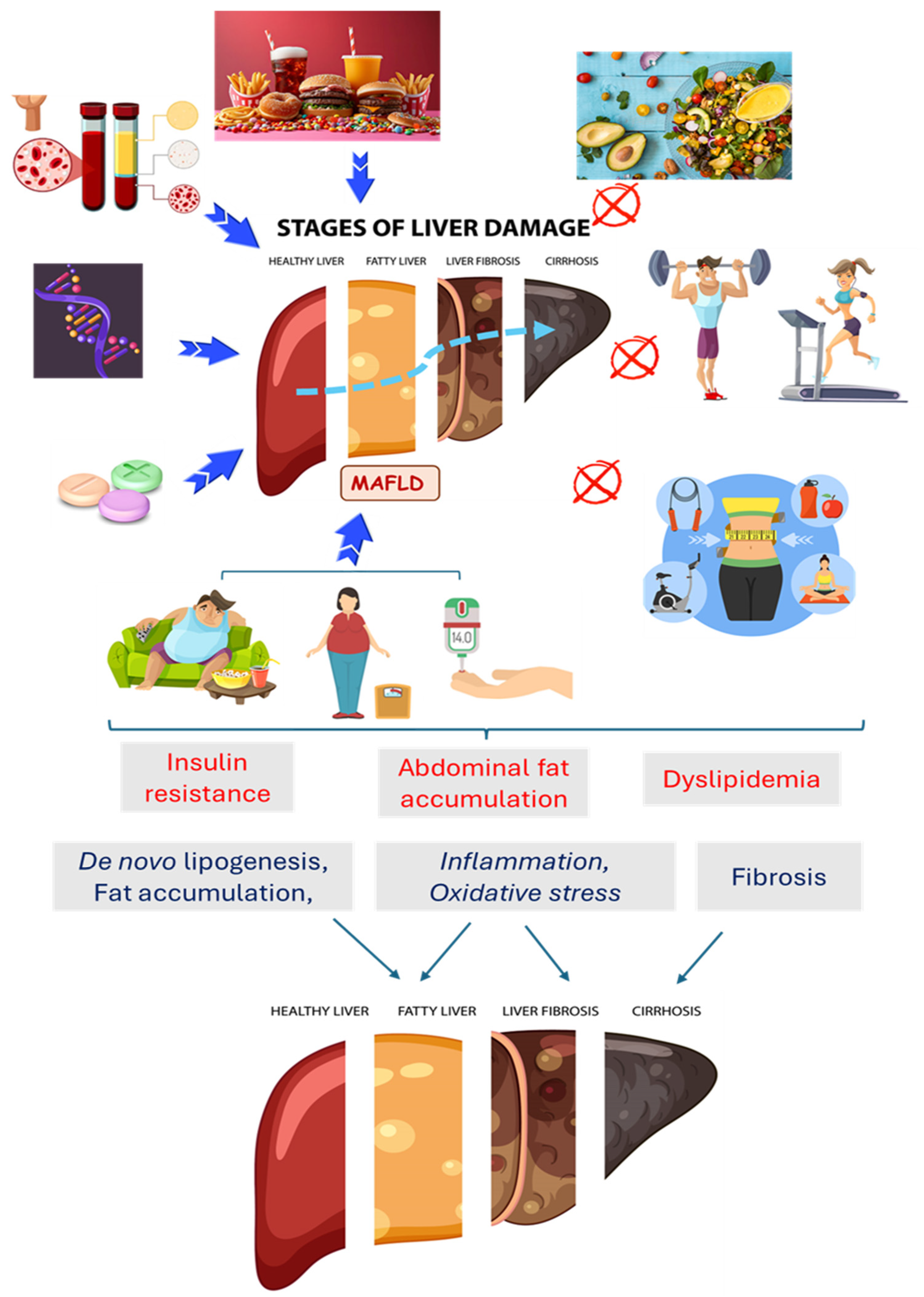 Metabolic-Associated Fatty Liver Disease: The Influence of Oxidative  Stress, Inflammation, Mitochondrial Dysfunctions, and the Role of  Polyphenols