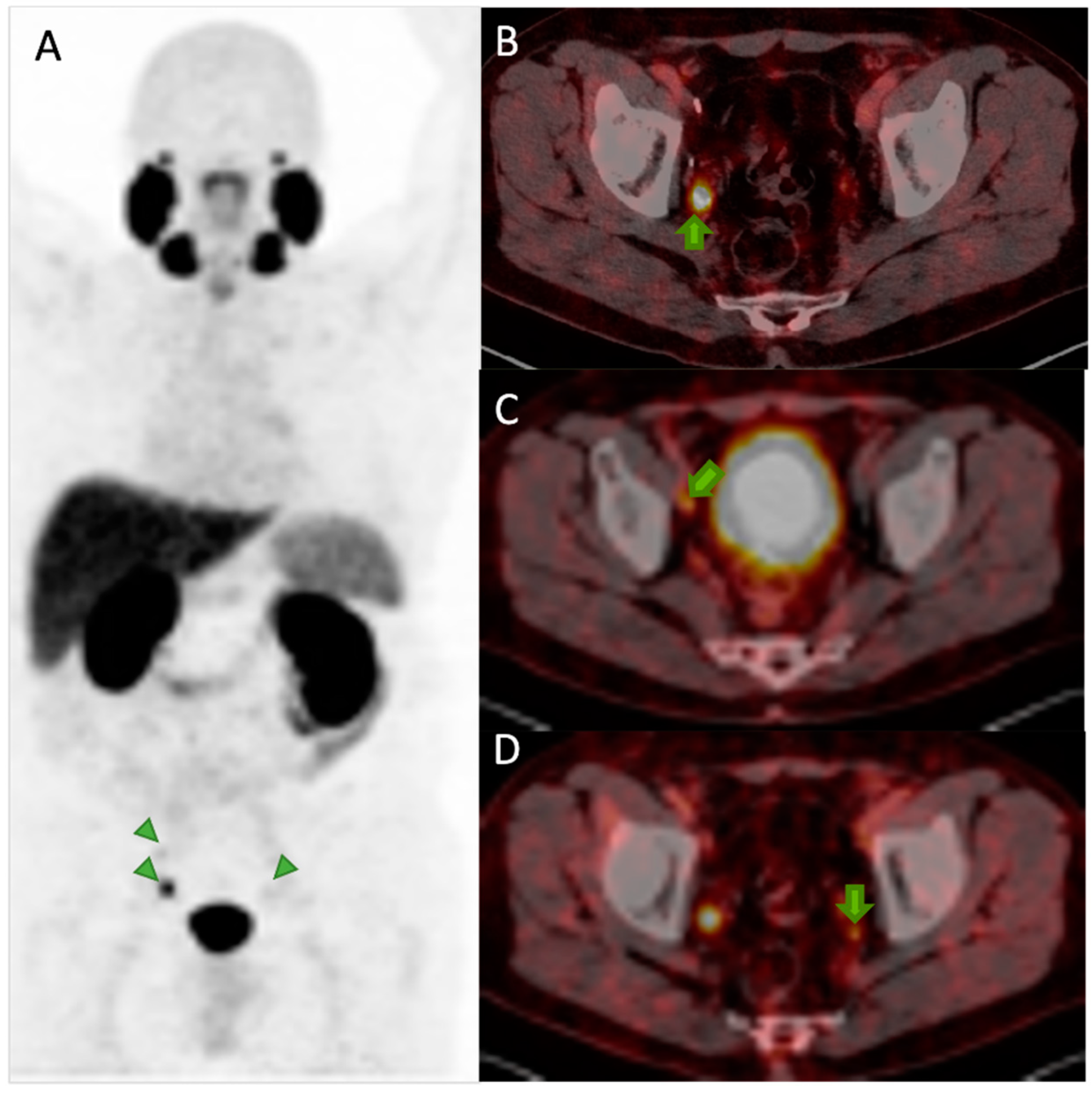 Pharmaceuticals 17 01483 g008