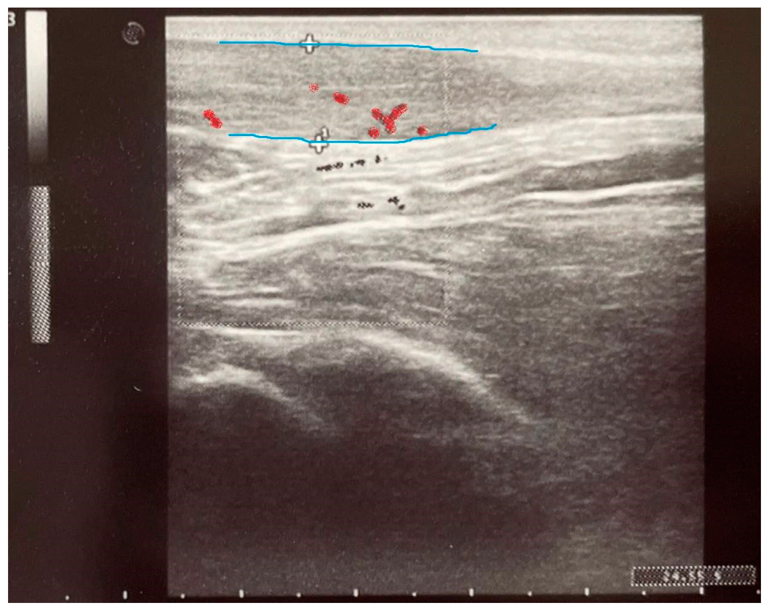 Pharmaceuticals 18 00575 g005
