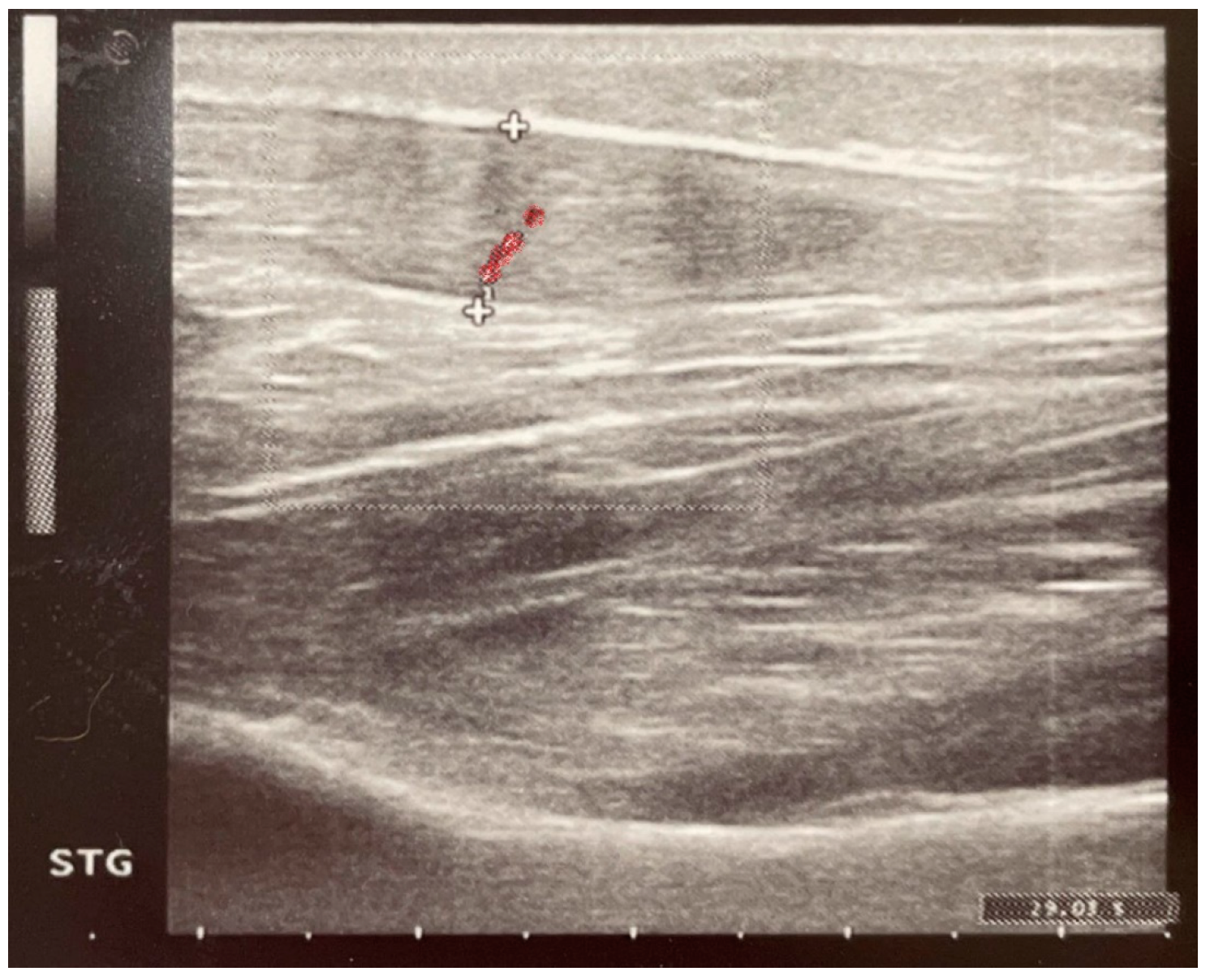 Pharmaceuticals 18 00575 g006