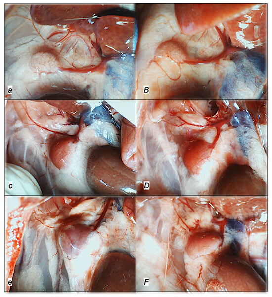 bpc 157 aneurysm Unilateral Adrenalectomy, and the Stable Pentadecapeptide BPC 157 as Therapy in Rats—A Cytoprotection Approach