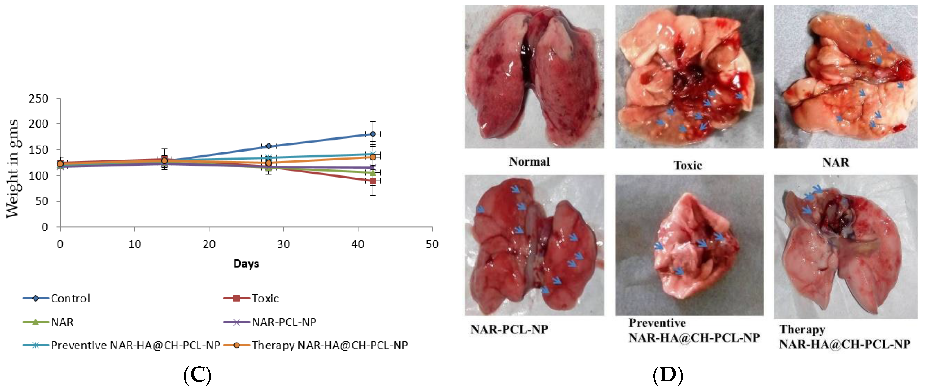 Overview of Breast Cancer Therapy - PMC