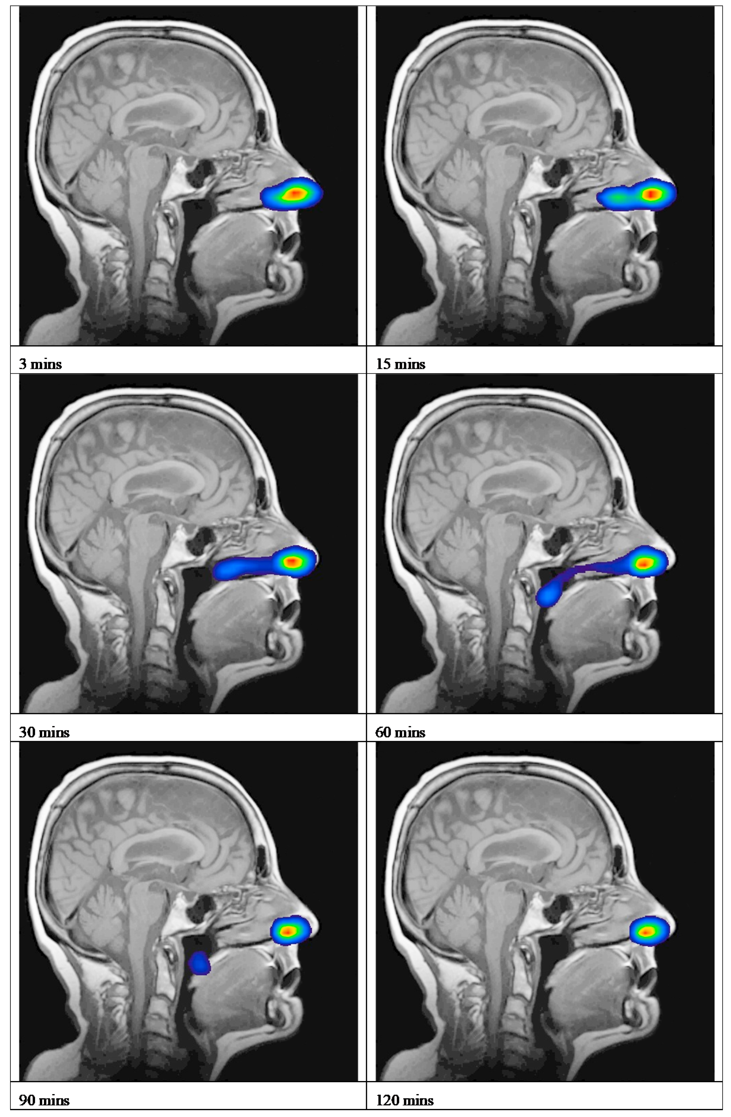 Pharmaceutics 11 00265 g002 Pharmaceutics 11 00265 g002