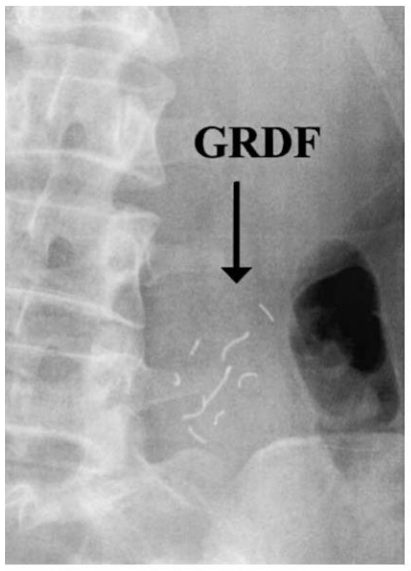 Pharmaceutics 11 00416 g016 Pharmaceutics 11 00416 g016