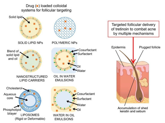 Nanodelivery Systems for Topical Management of Skin Disorders