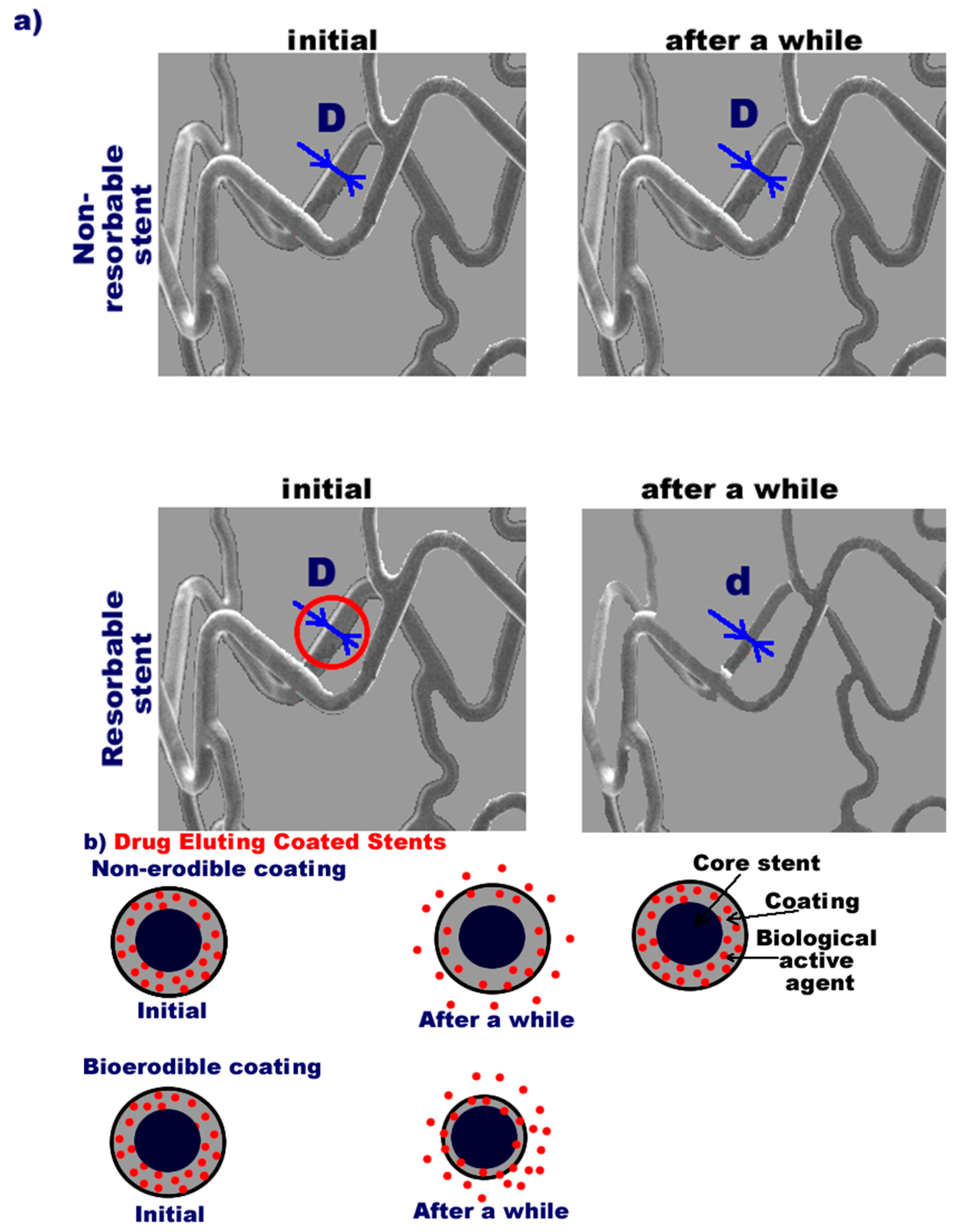 Pharmaceutics Free Full Text Recent Advances In Manufacturing Innovative Stents Html