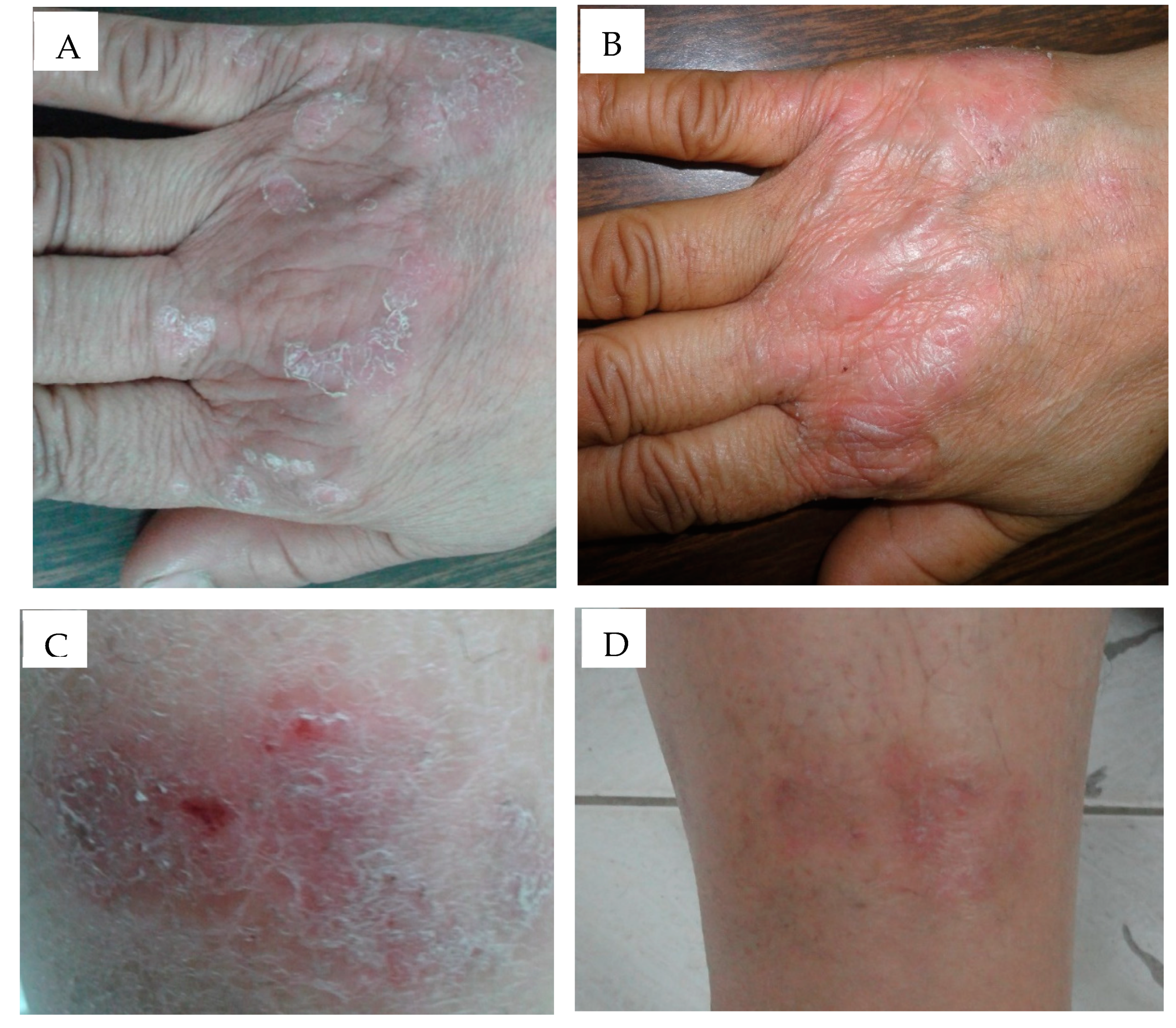 Pharmaceutics 12 00446 g006