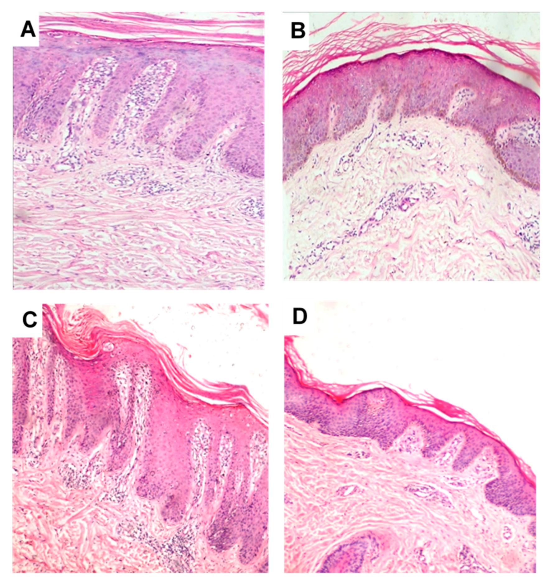 Pharmaceutics 12 00446 g007