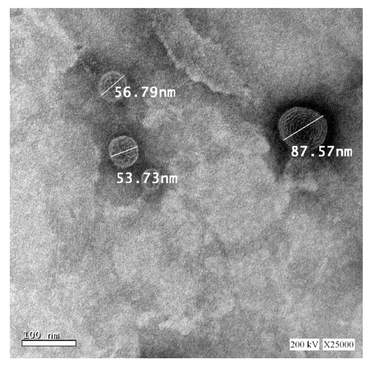 Pharmaceutics 12 00485 g005