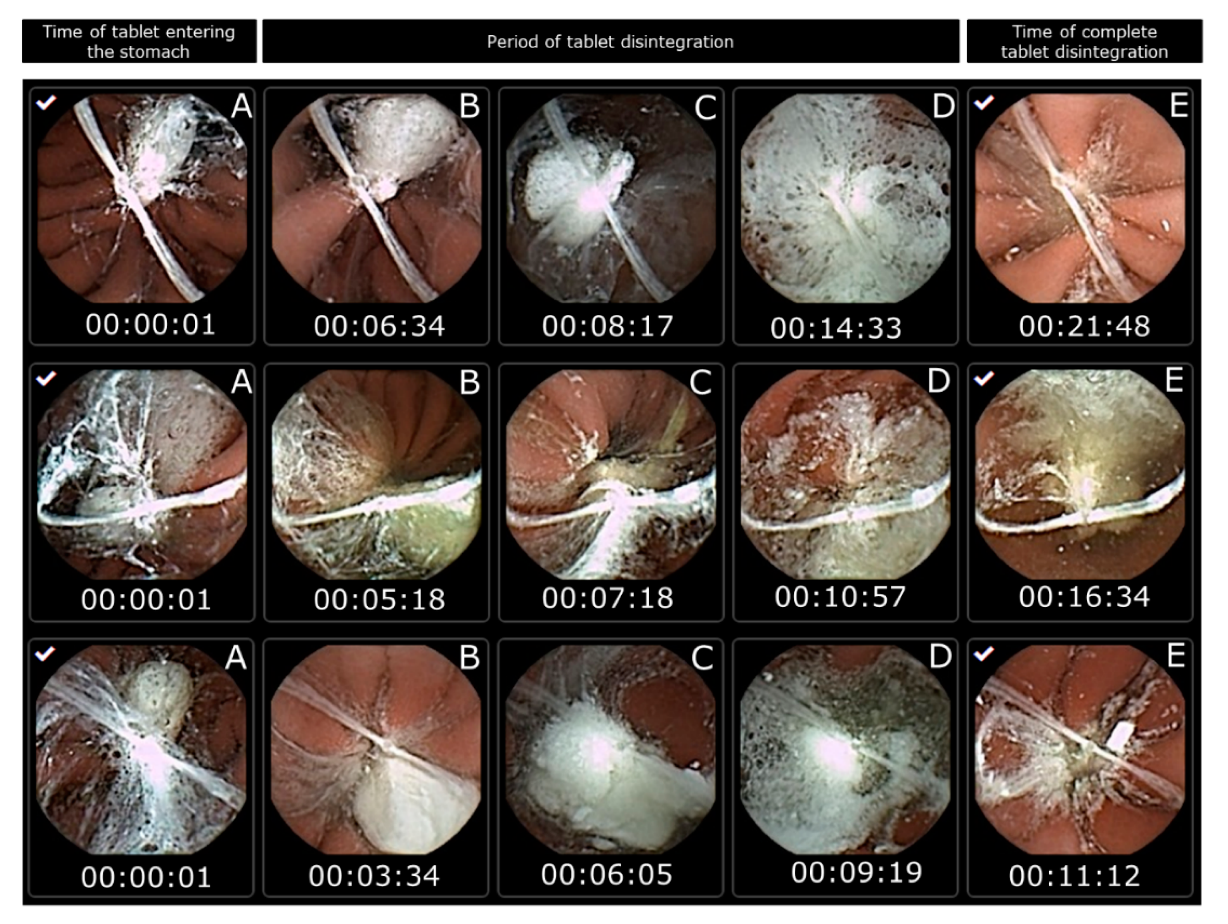 Pharmaceutics 12 00498 g003