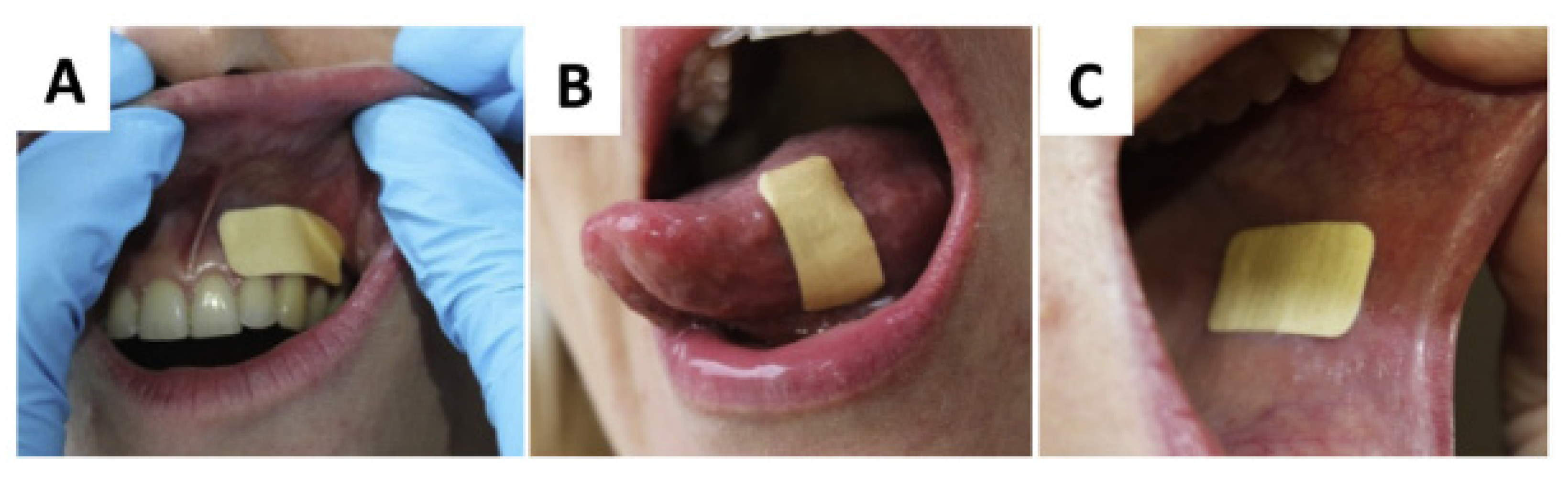 Pharmaceutics 12 00504 g004 Pharmaceutics 12 00504 g004