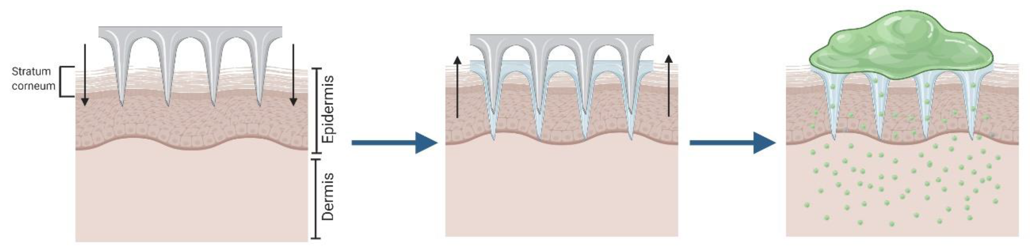 Pharmaceutics 12 00569 g001 Pharmaceutics 12 00569 g001
