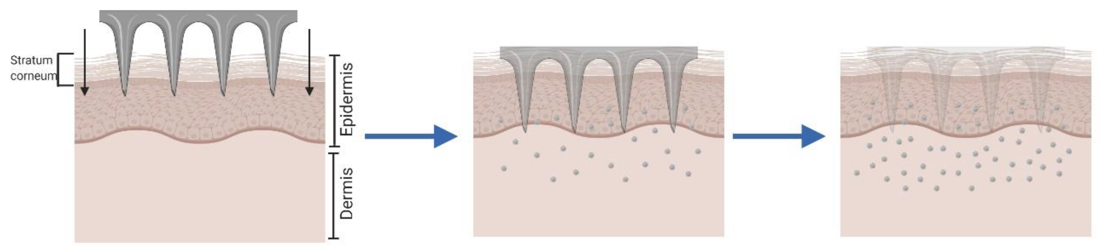 Pharmaceutics 12 00569 g003 Pharmaceutics 12 00569 g003