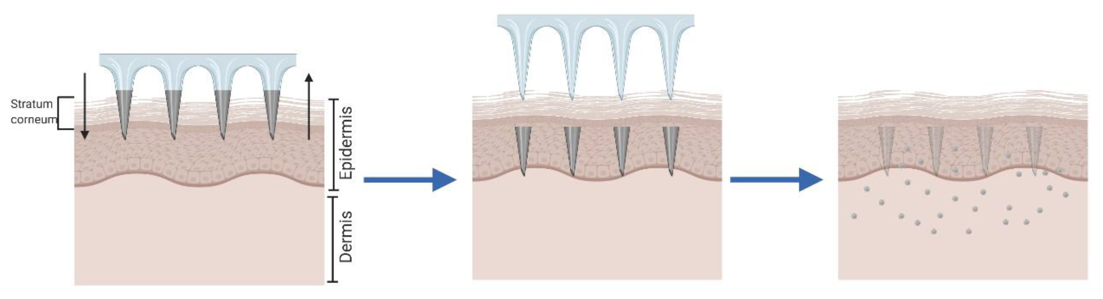 Pharmaceutics 12 00569 g004 Pharmaceutics 12 00569 g004