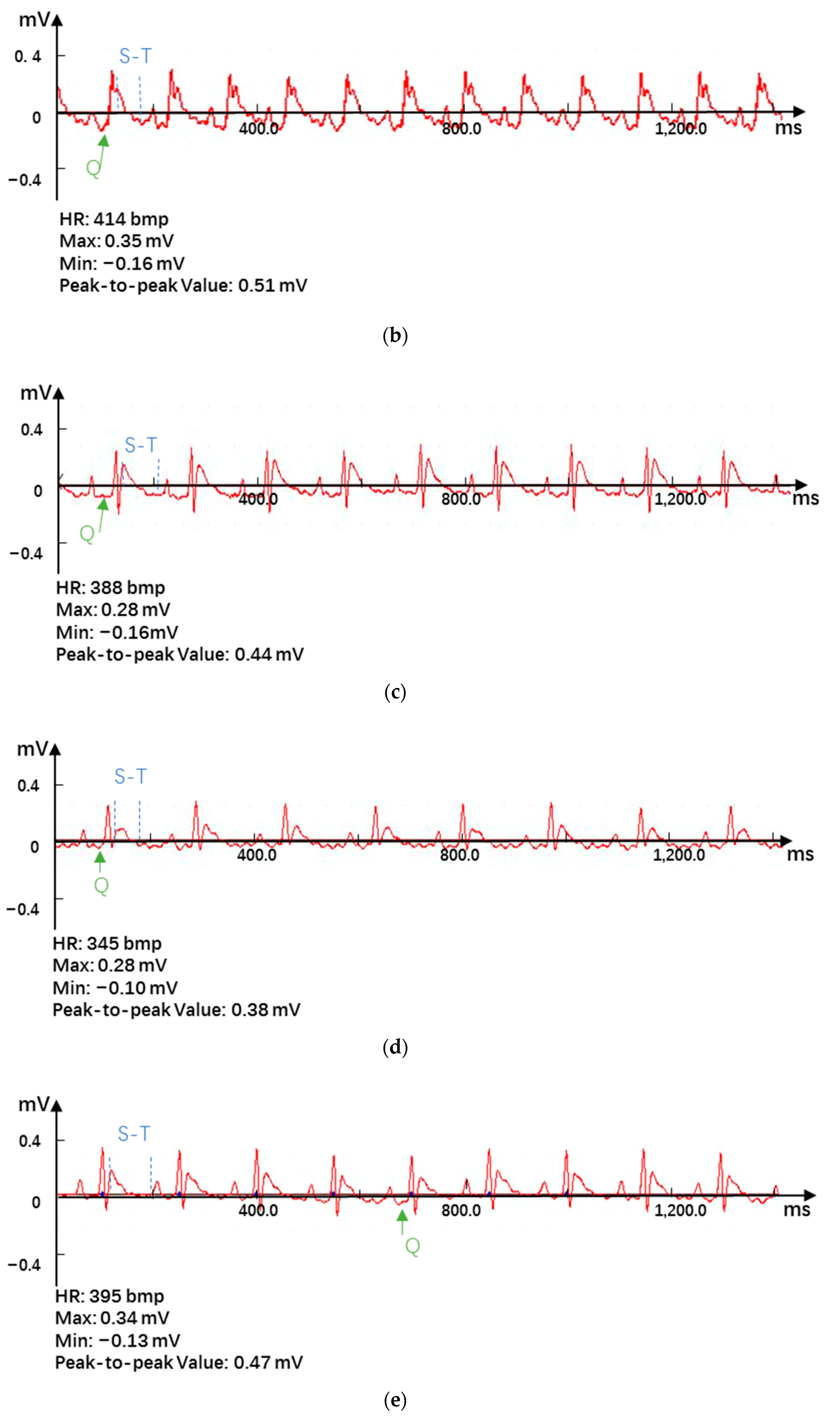 Pharmaceutics 12 00575 g004b Pharmaceutics 12 00575 g004b