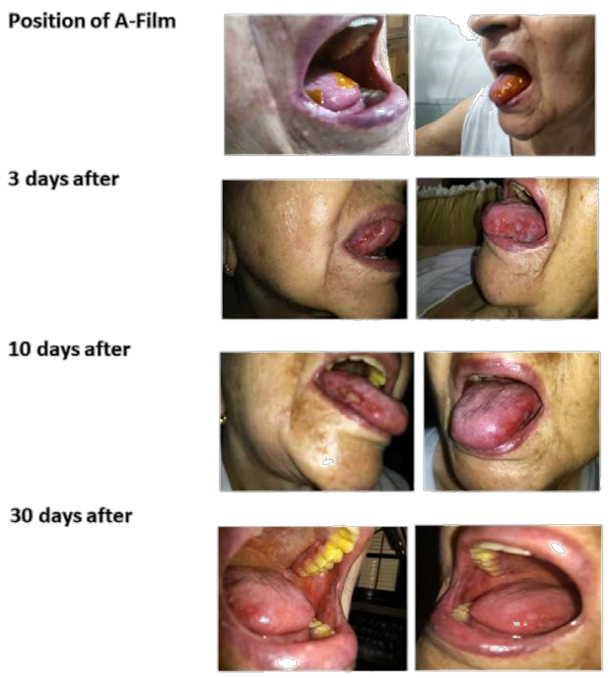 Pharmaceutics 12 00657 g013