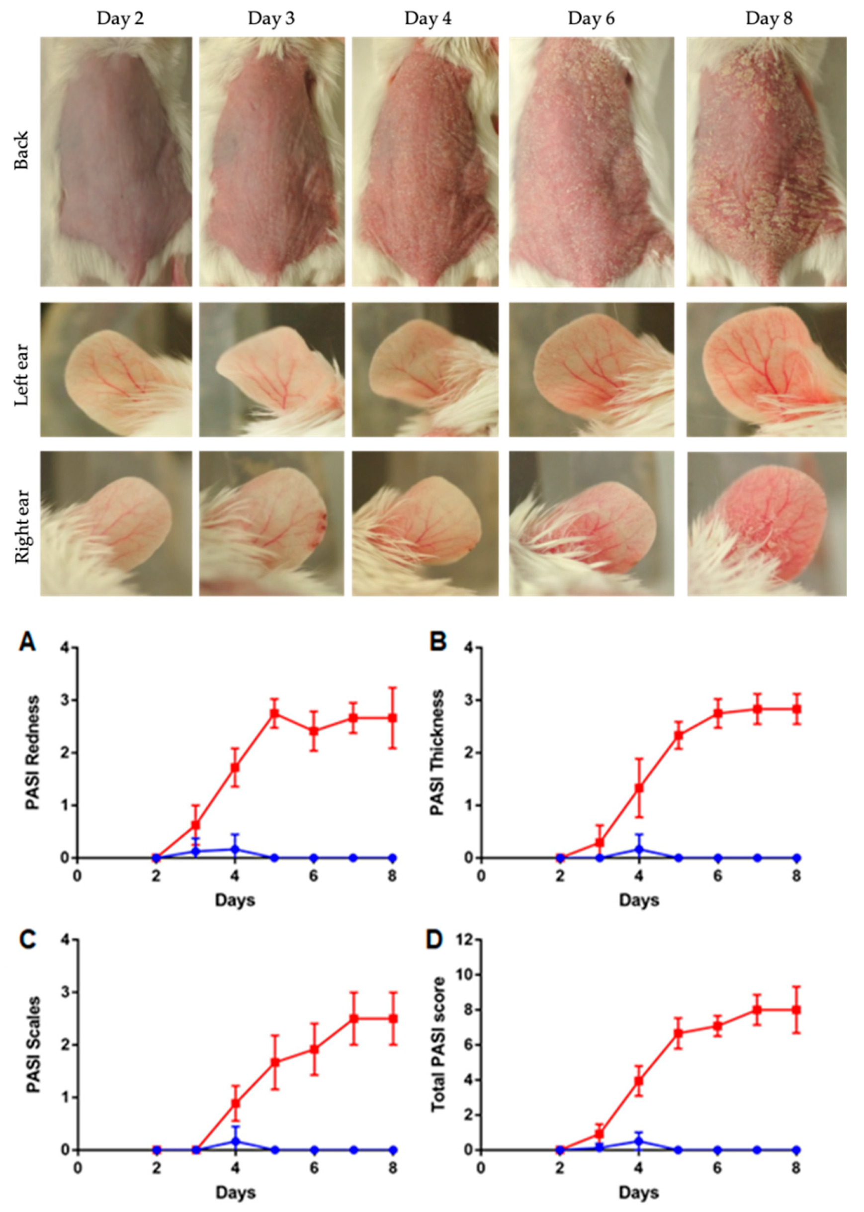 Pharmaceutics Free FullText Advanced Characterization of ImiquimodInduced PsoriasisLike