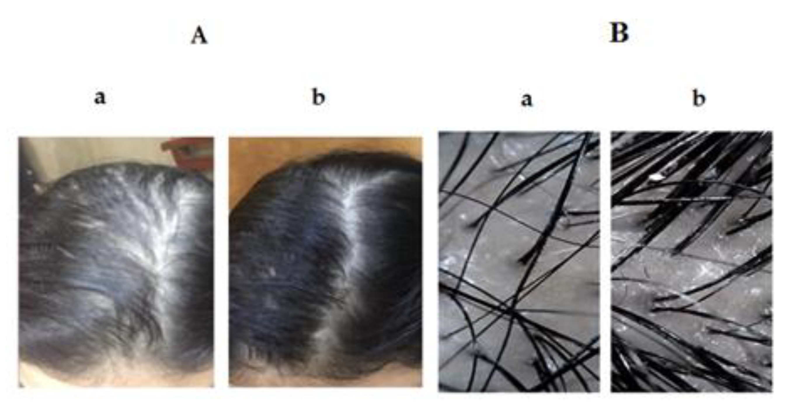 Pharmaceutics 12 00866 g011 Pharmaceutics 12 00866 g011