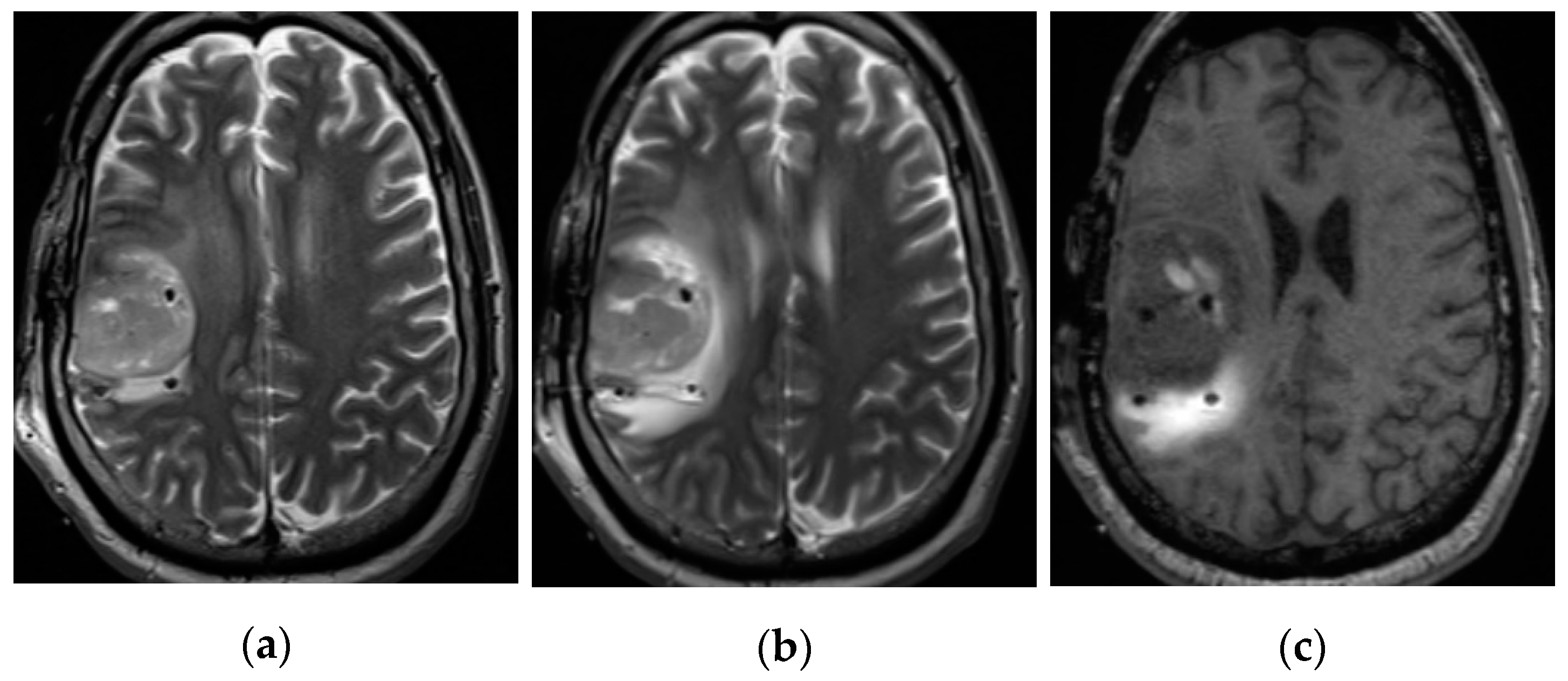 Pharmaceutics 12 00895 g001 Pharmaceutics 12 00895 g001