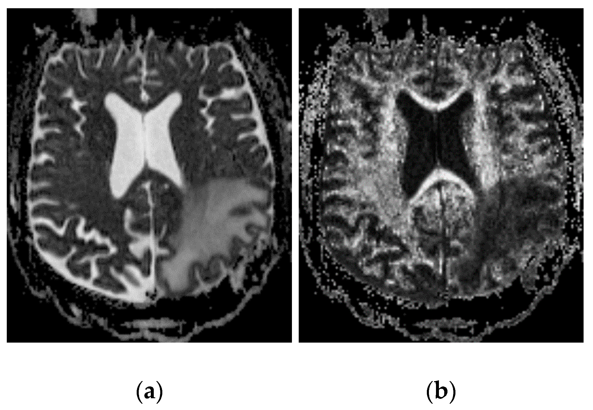 Pharmaceutics 12 00895 g002 Pharmaceutics 12 00895 g002