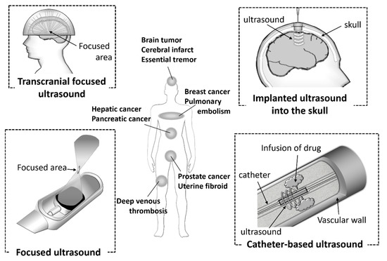 Pharmaceutics 12 00964 g004 550