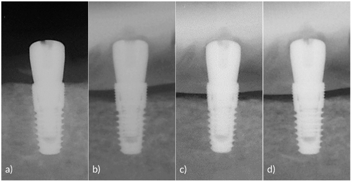 Pharmaceutics 12 01016 g002 Pharmaceutics 12 01016 g002