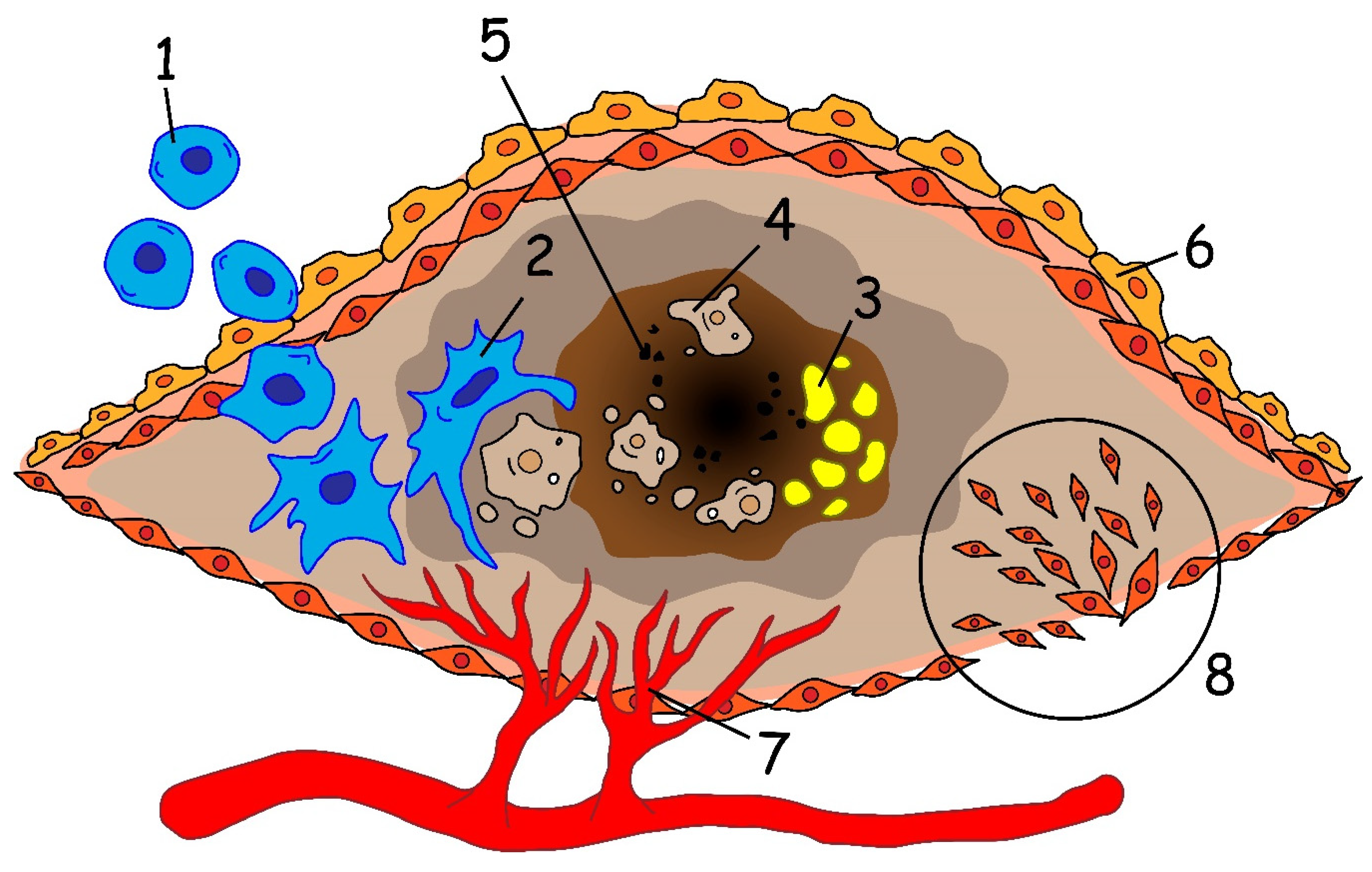 Penis atherome am Doktor Sex: