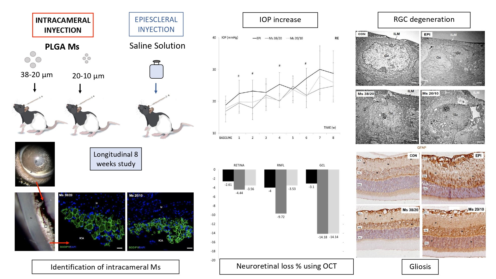 Pharmaceutics Free FullText Novel Use of PLGA Microspheres to