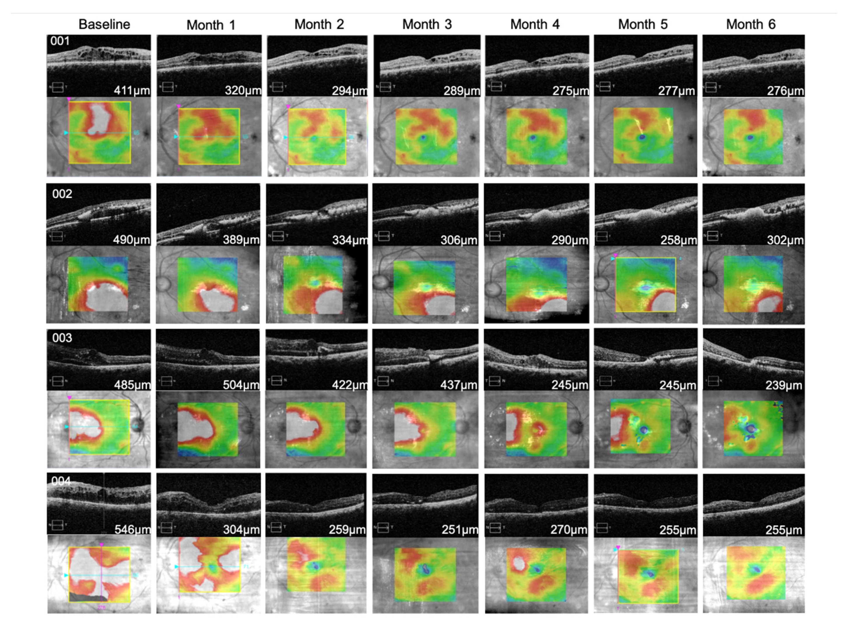 Pharmaceutics 13 00322 g005 Pharmaceutics 13 00322 g005