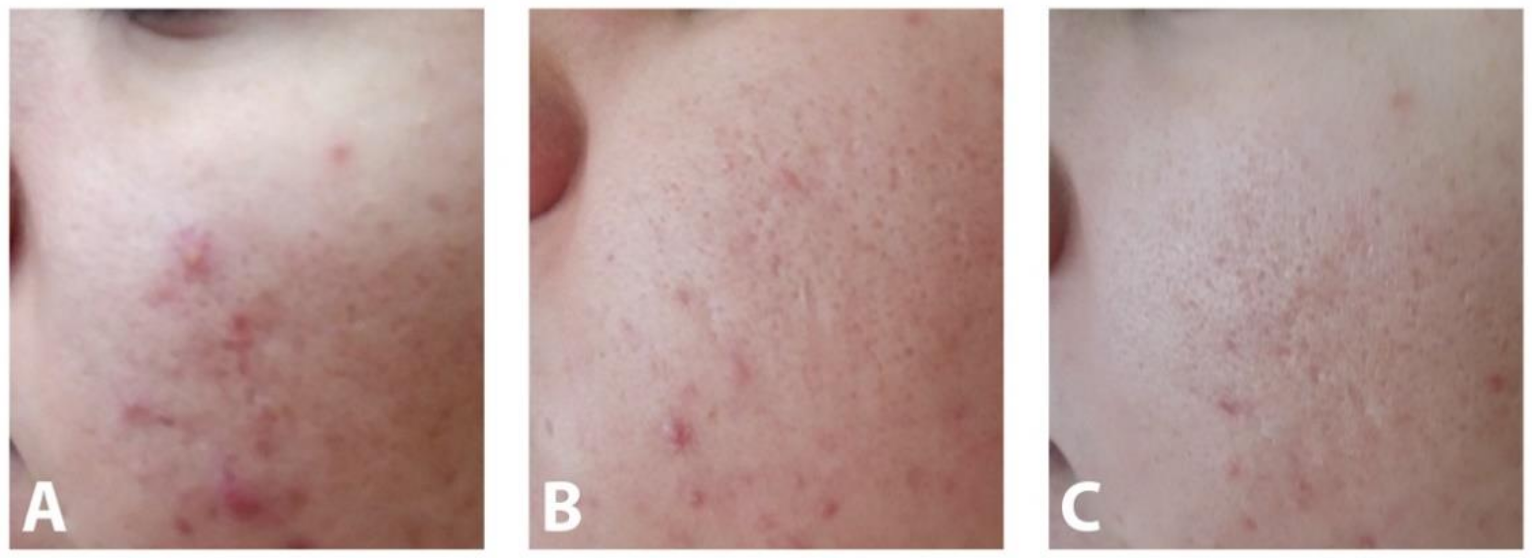 Pharmaceutics 13 00567 g003 Pharmaceutics 13 00567 g003