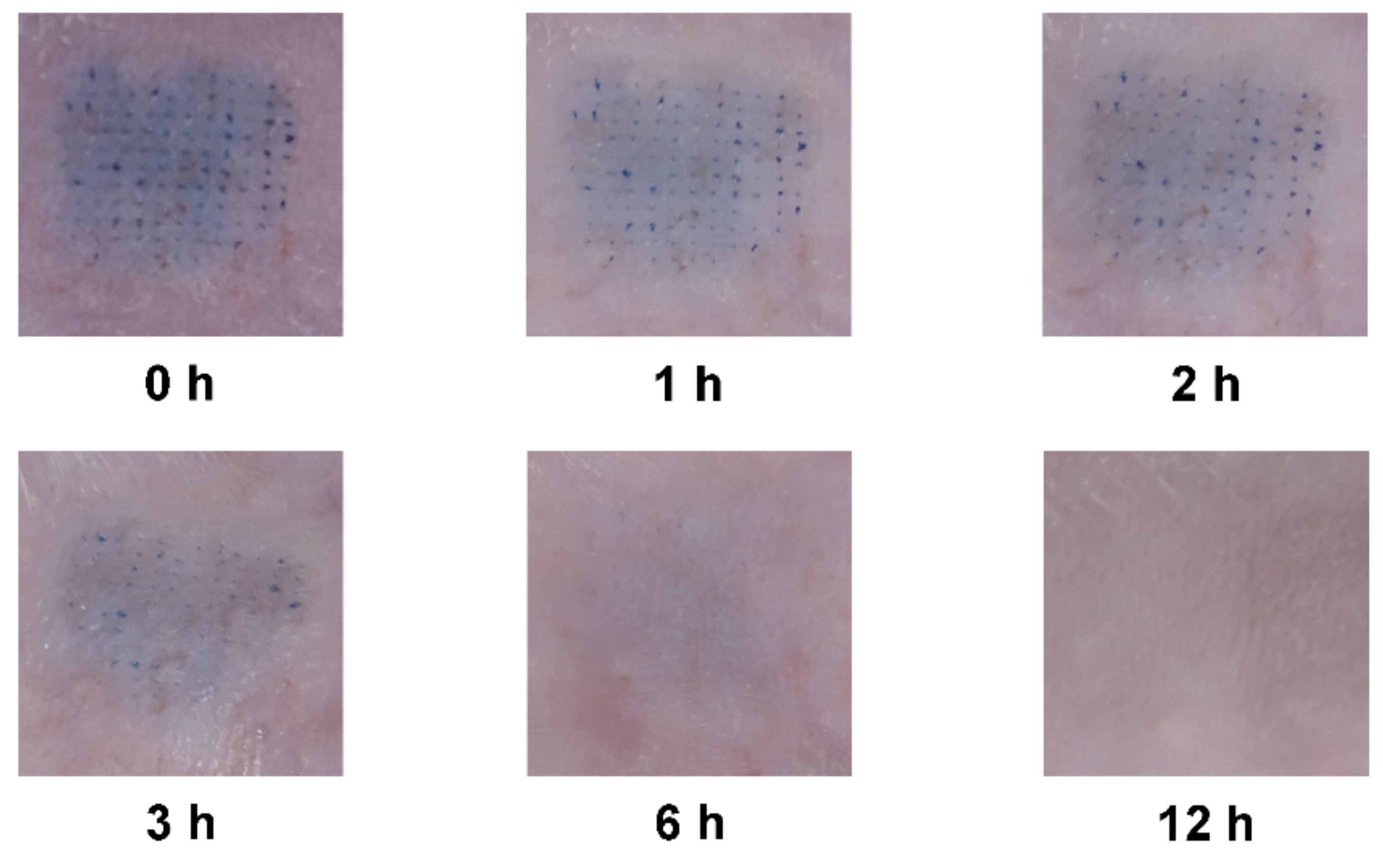 Pharmaceutics 13 00579 g006 Pharmaceutics 13 00579 g006