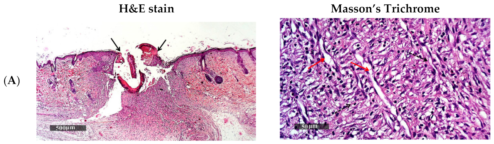 Pharmaceutics 13 00700 g010a Pharmaceutics 13 00700 g010a