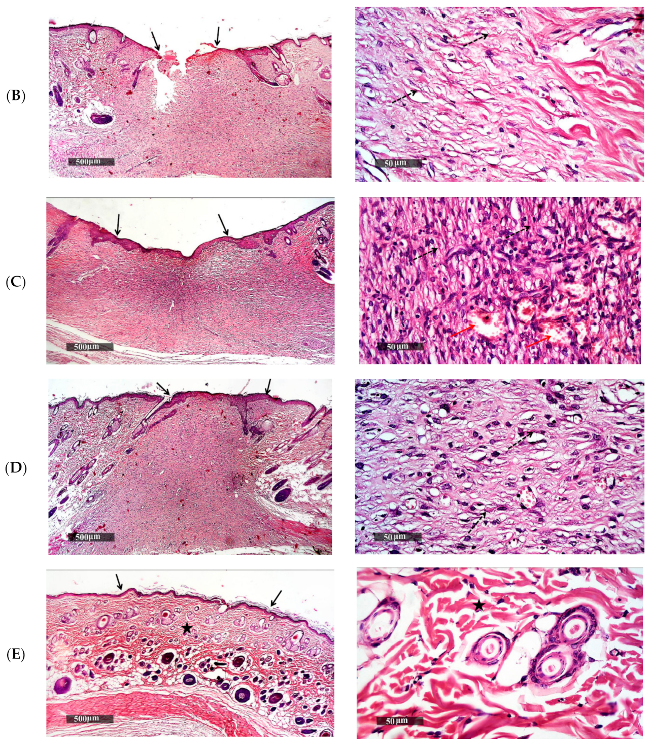 Pharmaceutics 13 00700 g010b Pharmaceutics 13 00700 g010b