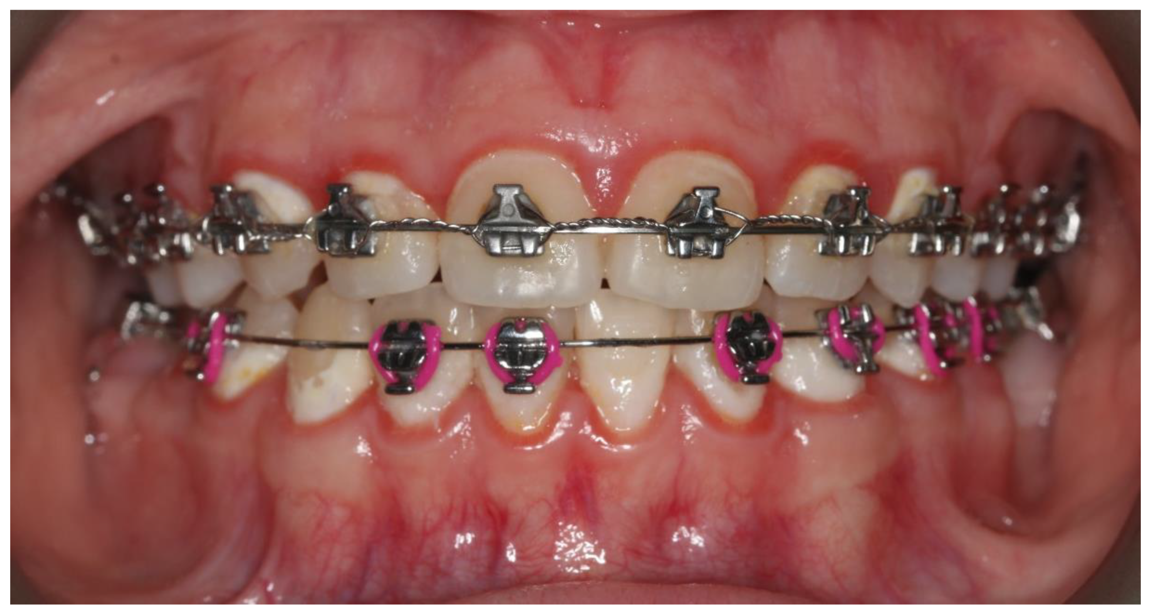 Pharmaceutics 13 00720 g002 Pharmaceutics 13 00720 g002