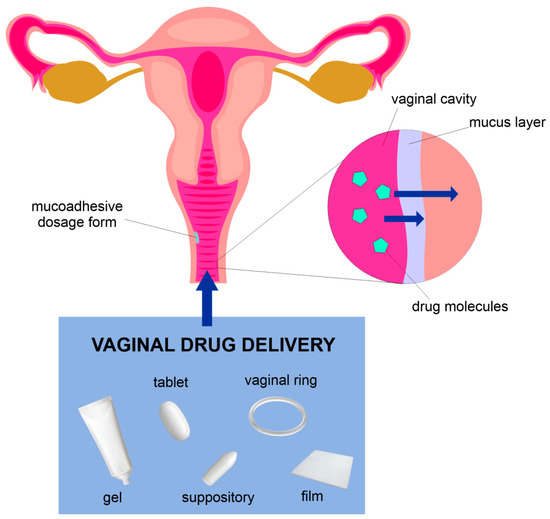 MB66 Sex Bí Mật Của Đời Sống Tình Dục Viên Mãn - Khám Phá