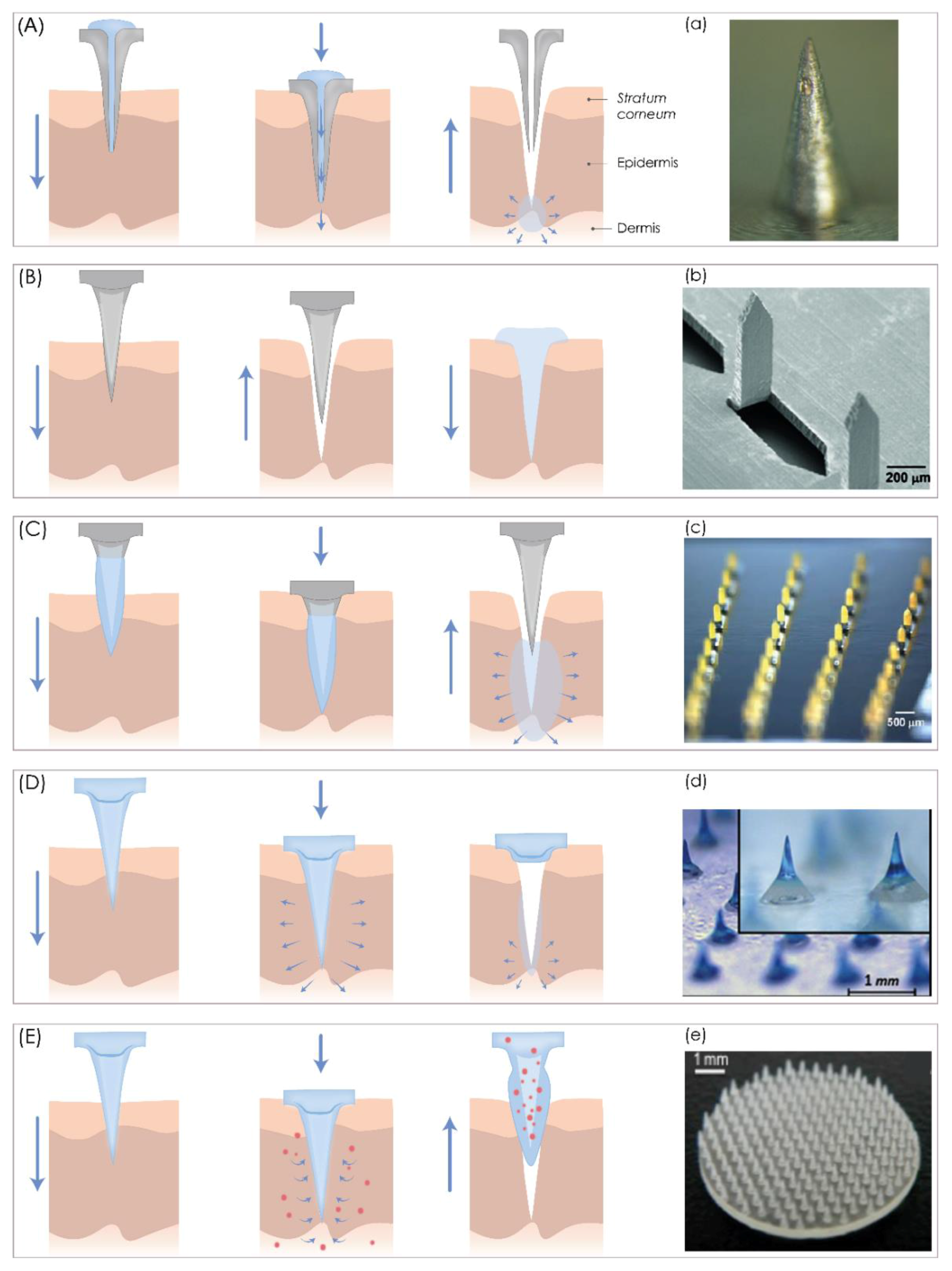 Pharmaceutics Free Full Text 3d Printing A Touch Button Approach To Manufacture Microneedles For Transdermal Drug Delivery Html