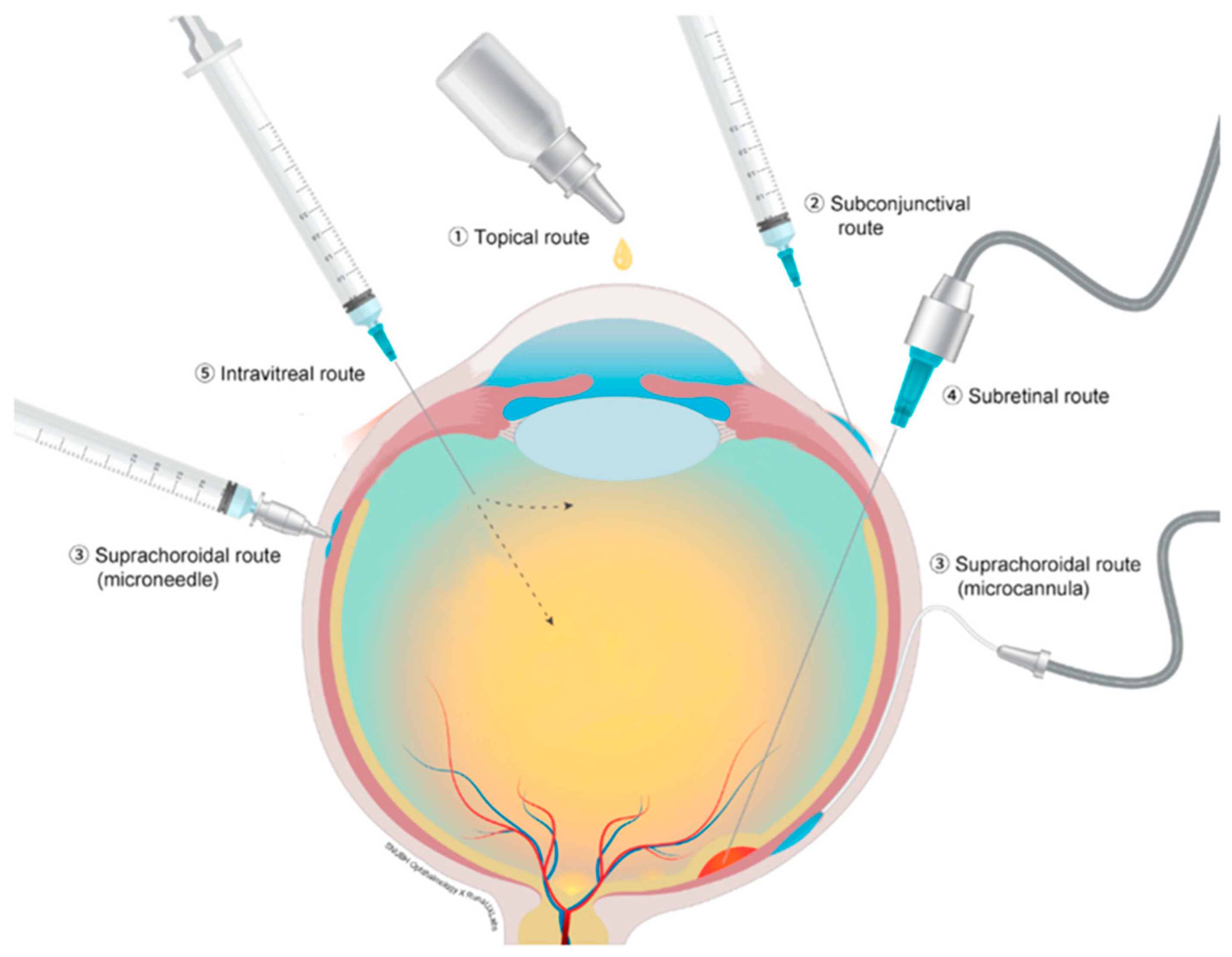 Pharmaceutics Free FullText Drug Delivery via the Suprachoroidal