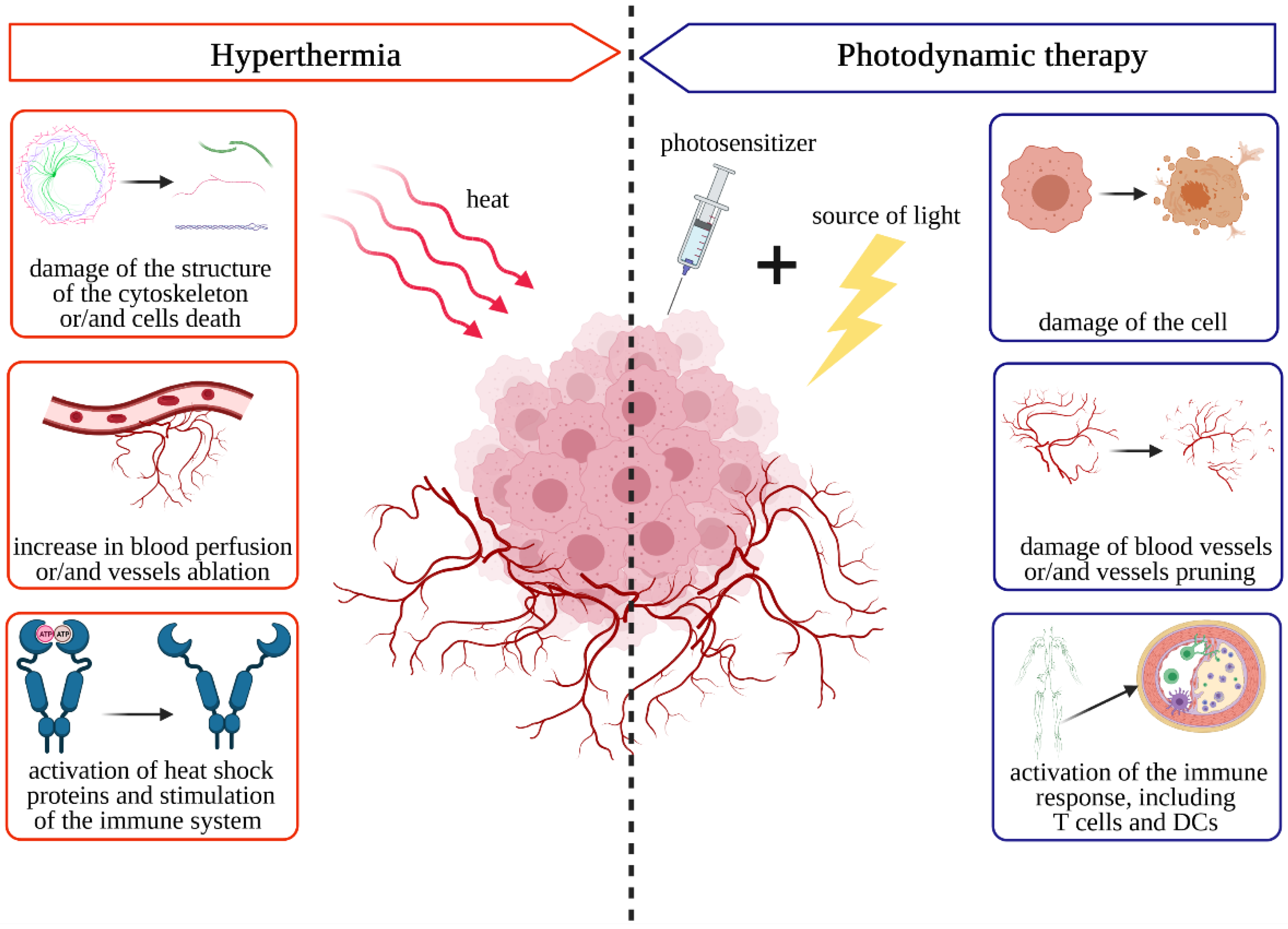 Pharmaceutics Free FullText Photodynamic Therapy and Hyperthermia