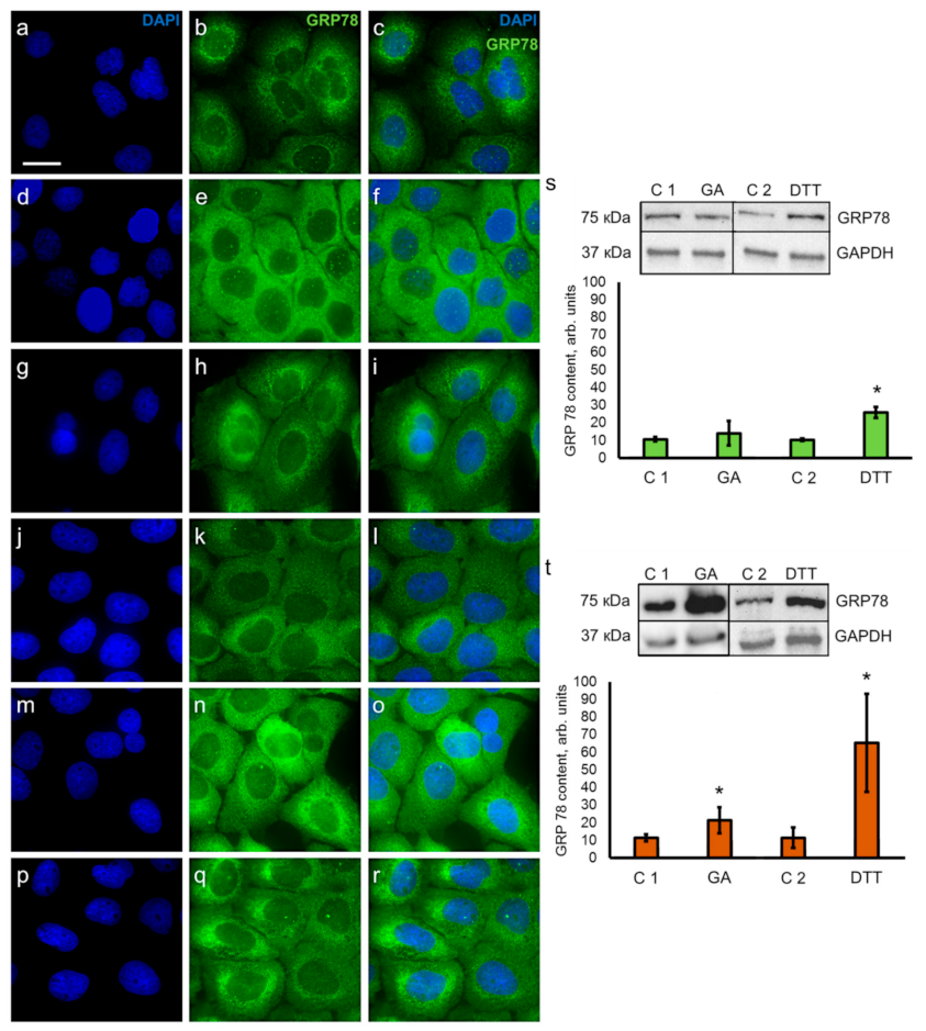 Pharmaceutics 13 01813 g002 Pharmaceutics 13 01813 g002