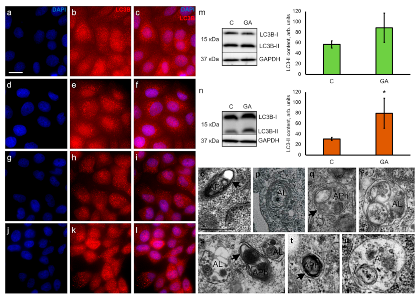 Pharmaceutics 13 01813 g003 Pharmaceutics 13 01813 g003