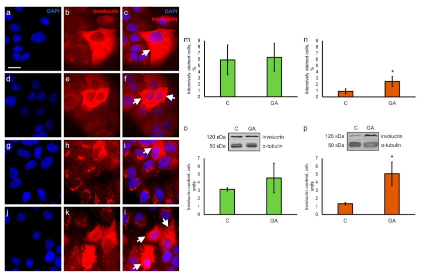 Pharmaceutics 13 01813 g004 Pharmaceutics 13 01813 g004