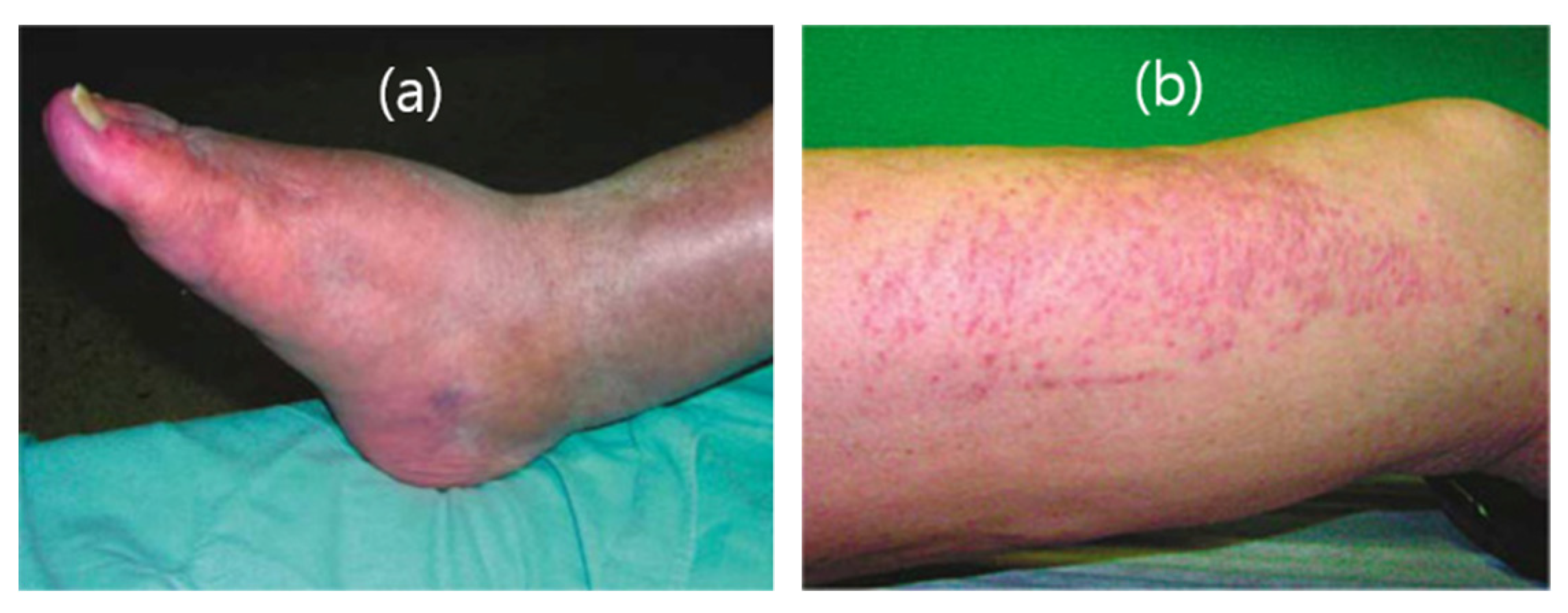 Pharmaceutics 13 01890 g018