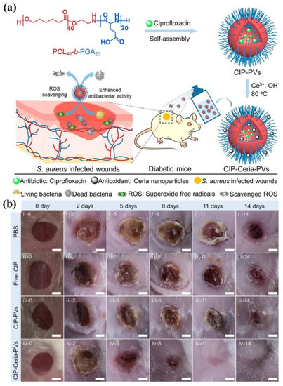 Polymeric Nanomaterials for Efficient Delivery of Antimicrobial Agents