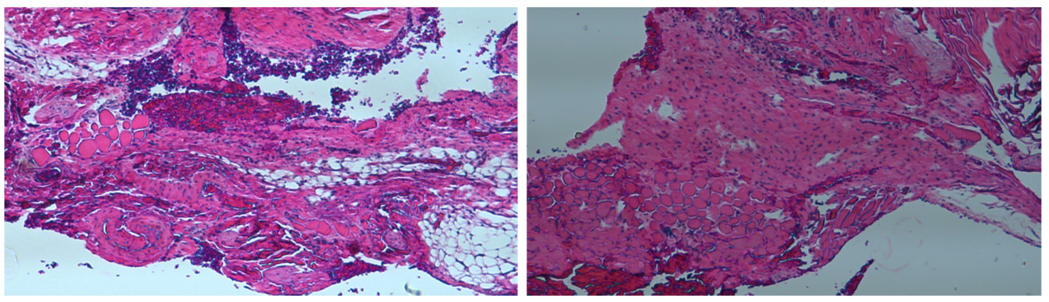Pharmaceutics 14 00374 g015