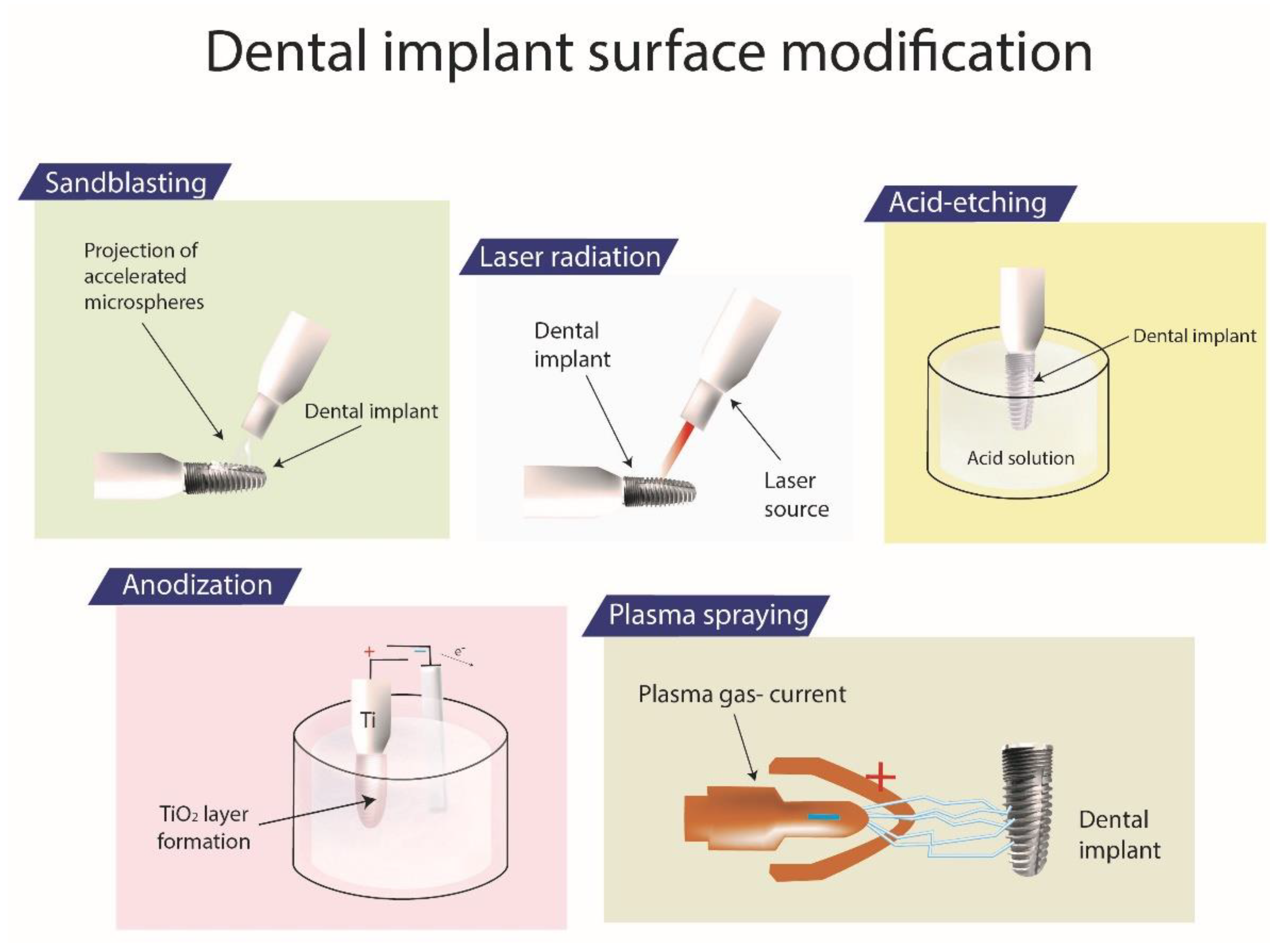 Pharmaceutics Free FullText Latest Trends in Surface Modification