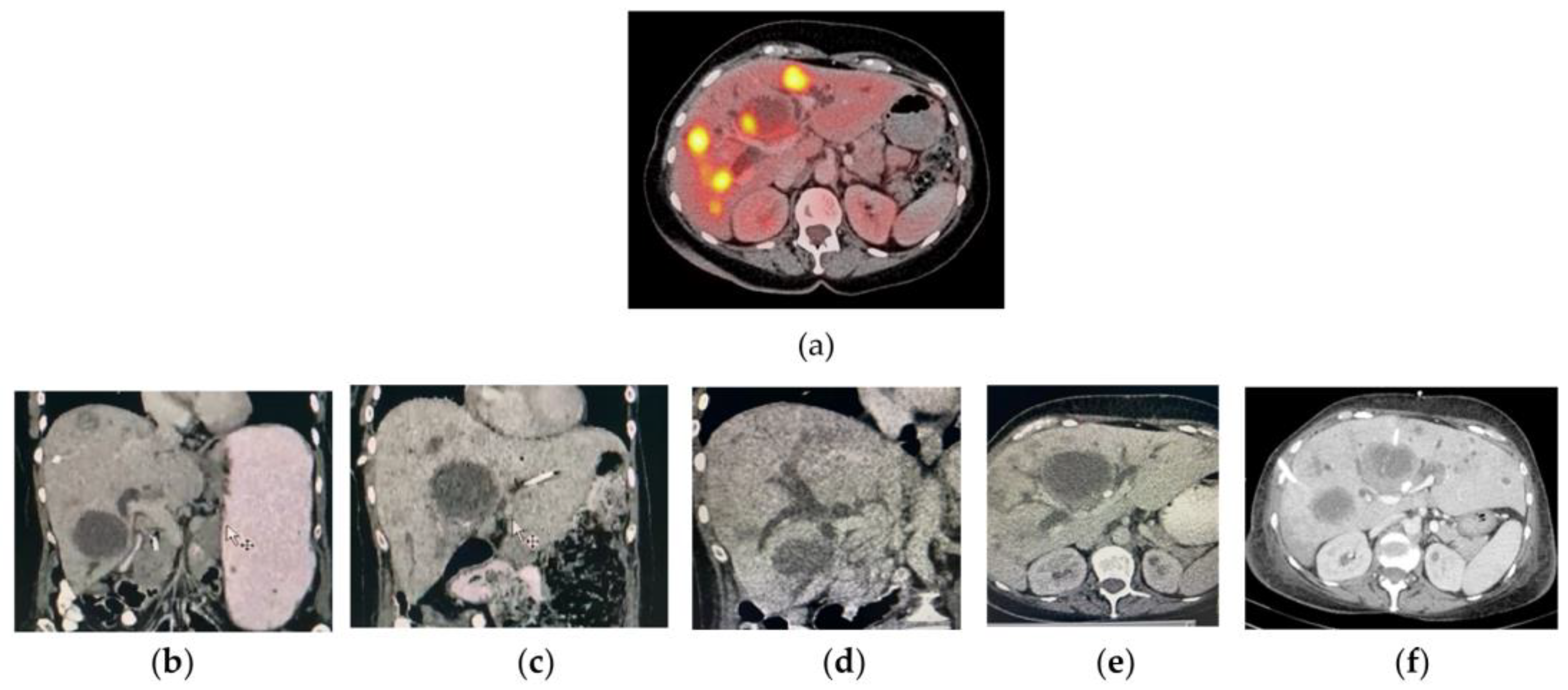 Pharmaceutics 14 00720 g0a1
