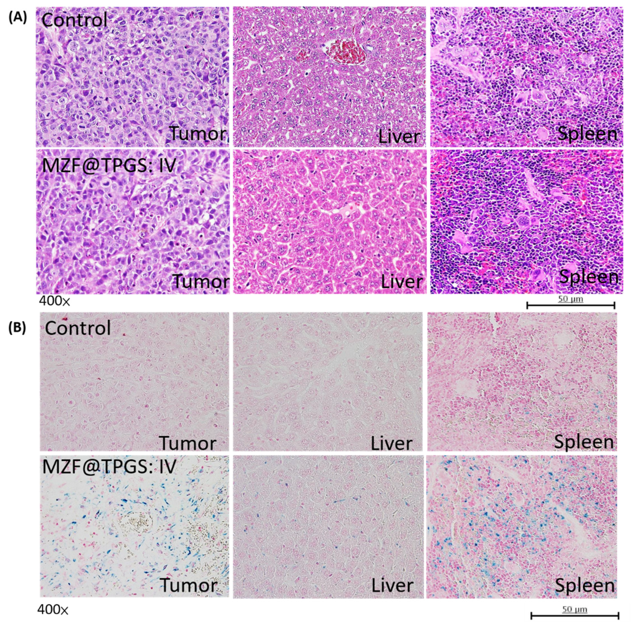 Pharmaceutics 14 01000 g007