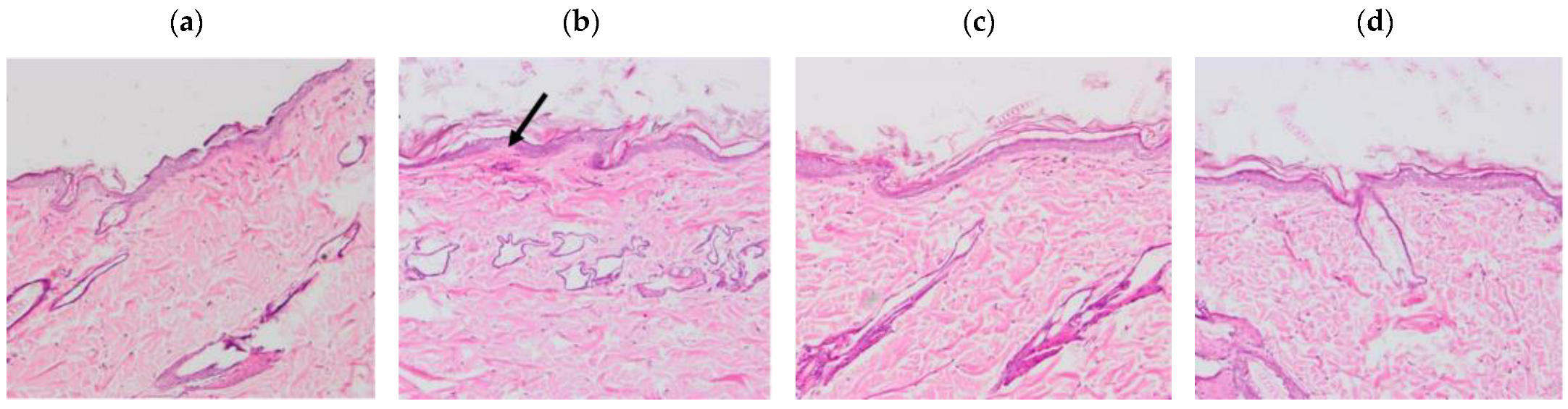 Pharmaceutics 14 01011 g007 550